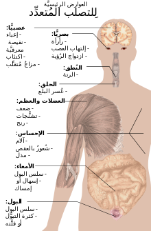 Symptoms_of_multiple_sclerosis